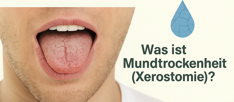 XyliMelts® – Die natürliche Lösung für Mundtrockenheit